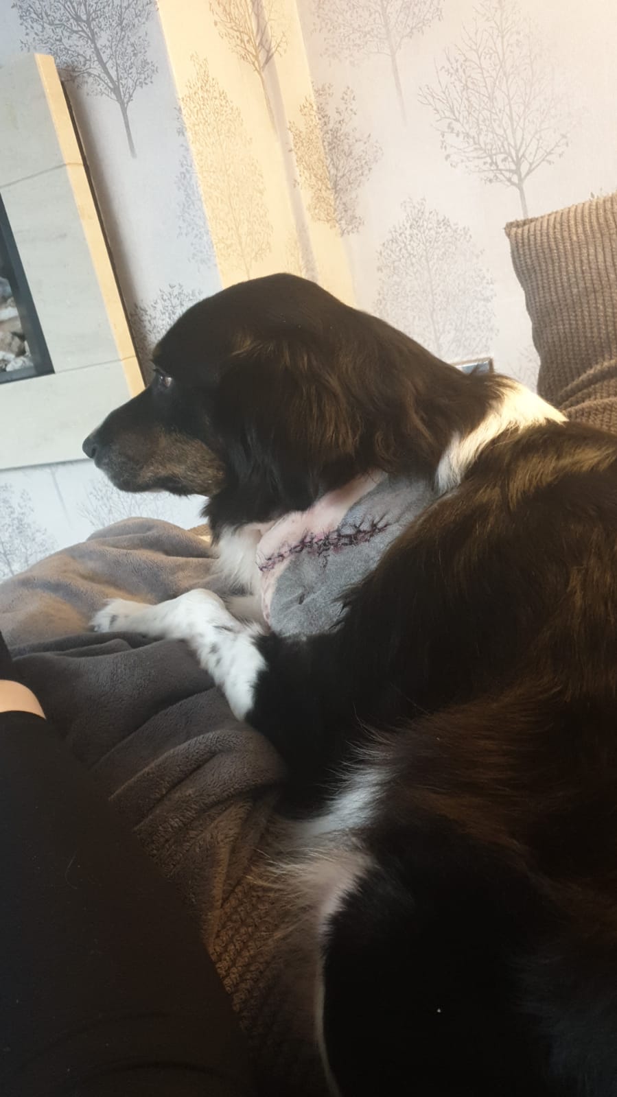 After the op