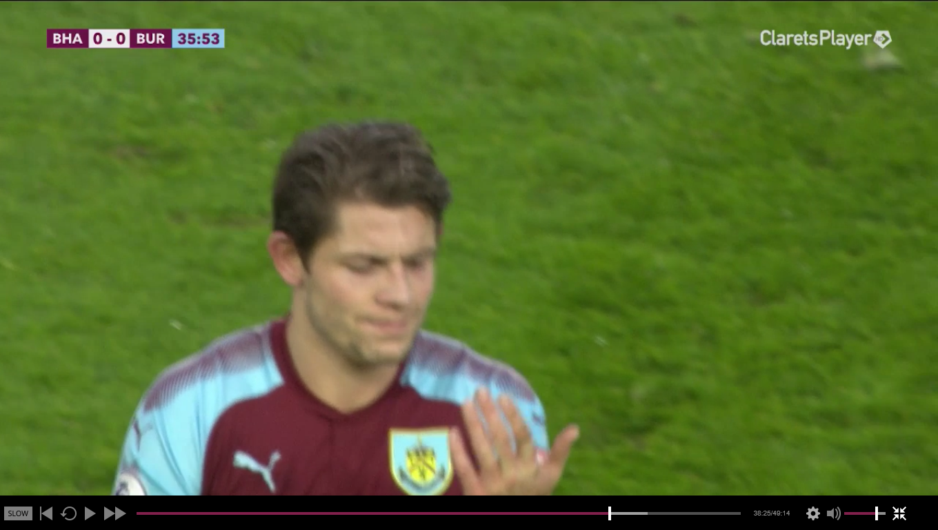 Any medics? Is that dislocated?